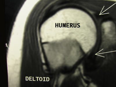 For once, I couldn`t come up with a humerus caption.