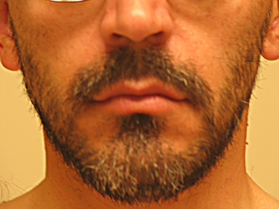 My five o`clock shadow.