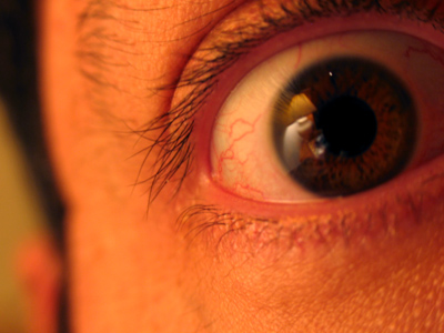 Adam Alonzo, allergy sufferer.