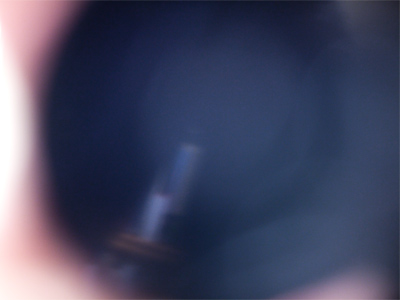 Food poisoning, scene 5 of 5.