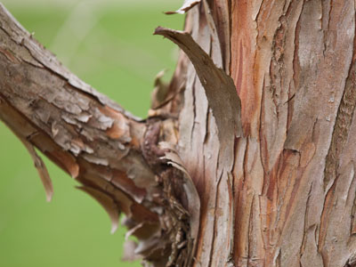 My skin gets this way in the winter.