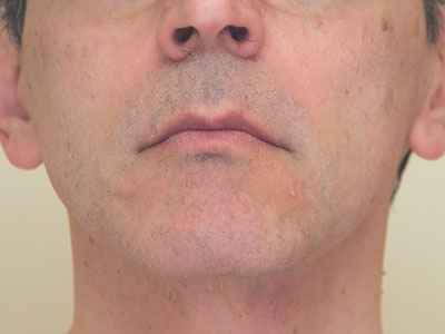 TIRED OF YOUR BOYISH FACE?