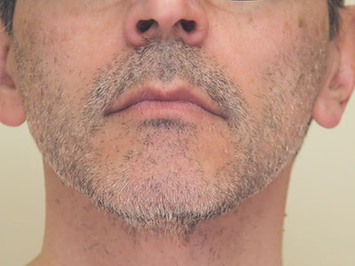 GROW SOME FACIAL HAIR LIKE A MAN!