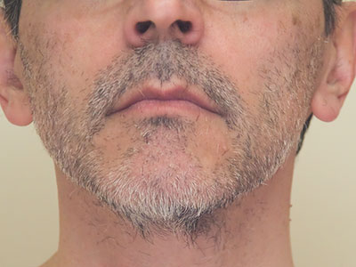 SEE RESULTS IN HOURS, NOT DAYS!