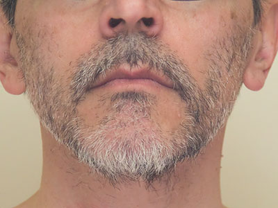 ALL-NATURAL FORMULA!  TOTALLY SAFE!