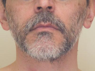 ONLY $49.95 FOR A SIX-MONTH SUPPLY!